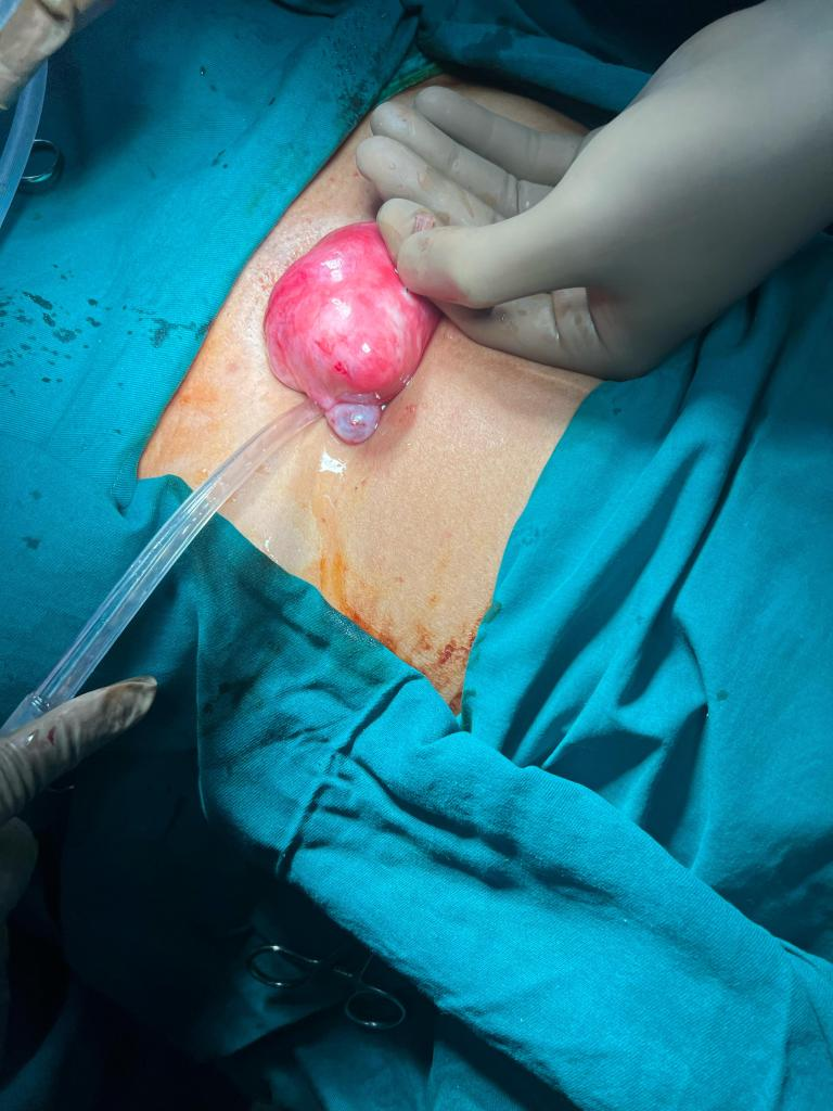 Safe Abortion Pills in Bangalore at Revive Hospitals